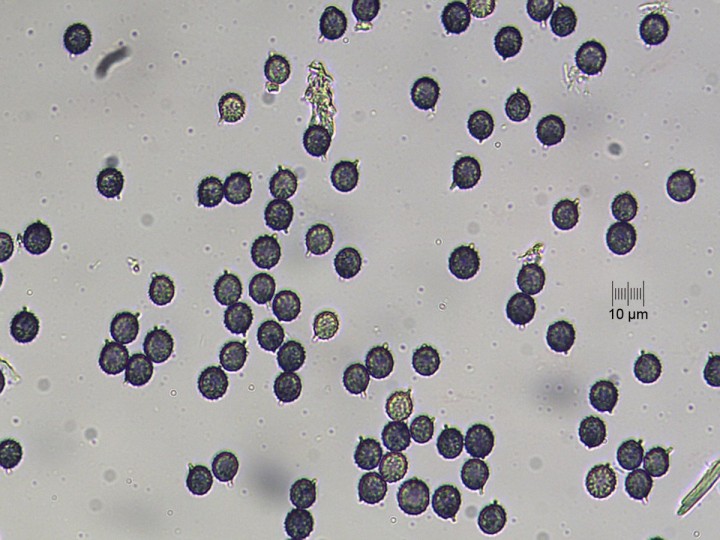 spores_x400_02.jpg