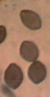 spores P acuminatus 1.jpg