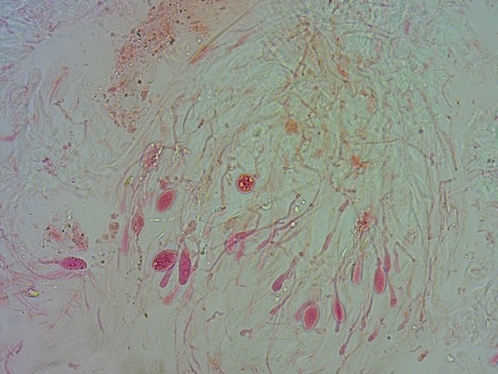 x40RCA+phloxine