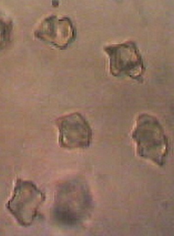 spores inconnu 1.jpg