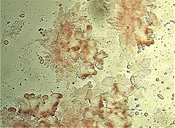 CYSTIDES (2).jpg