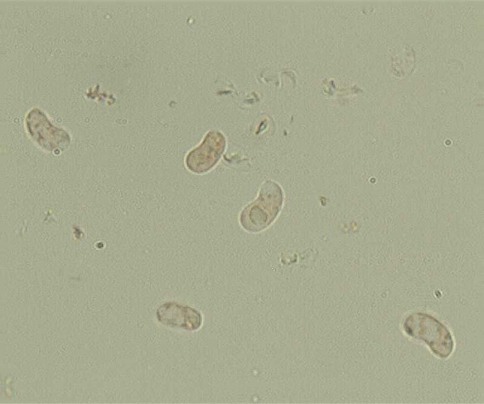 Resupinatus spores assemblage combined resized.jpg