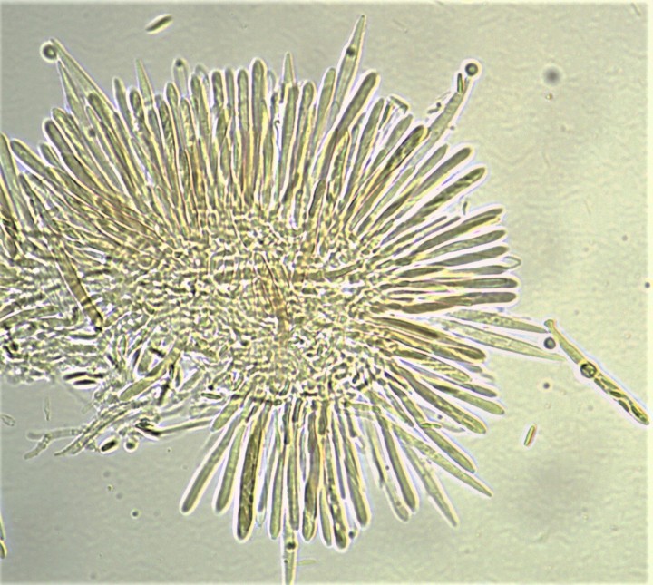Paraphyses