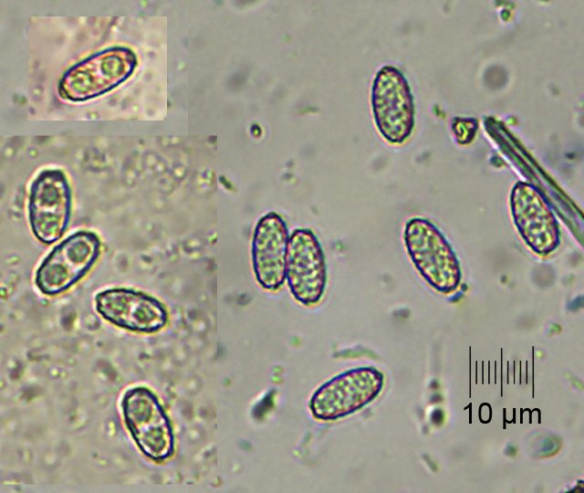 spores_x400.jpg