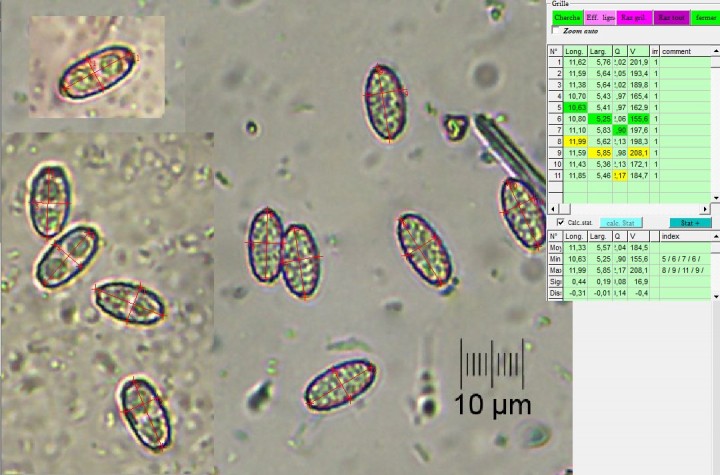 spores_x400.jpg