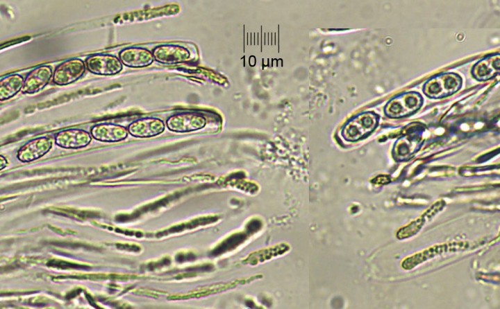 paraphyses_H2O.jpg