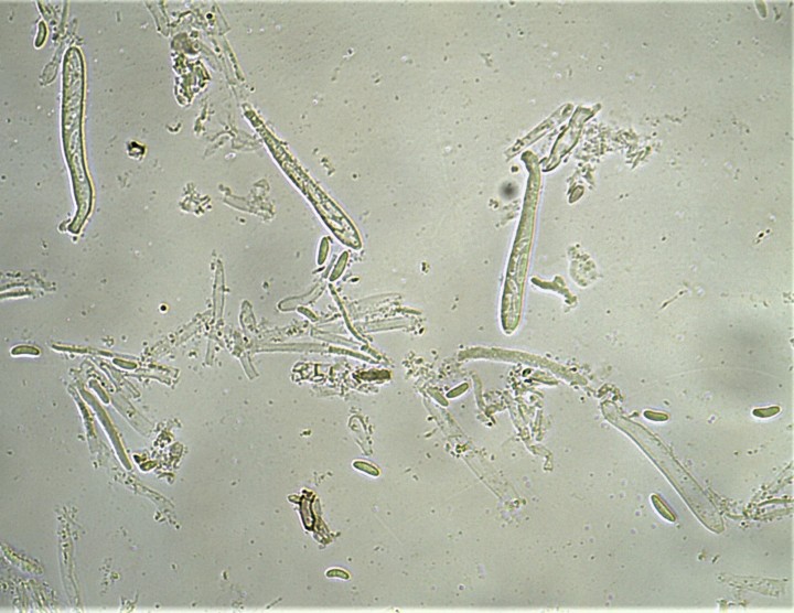 Spores 7,8-9 x 2-2,6µ.jpg