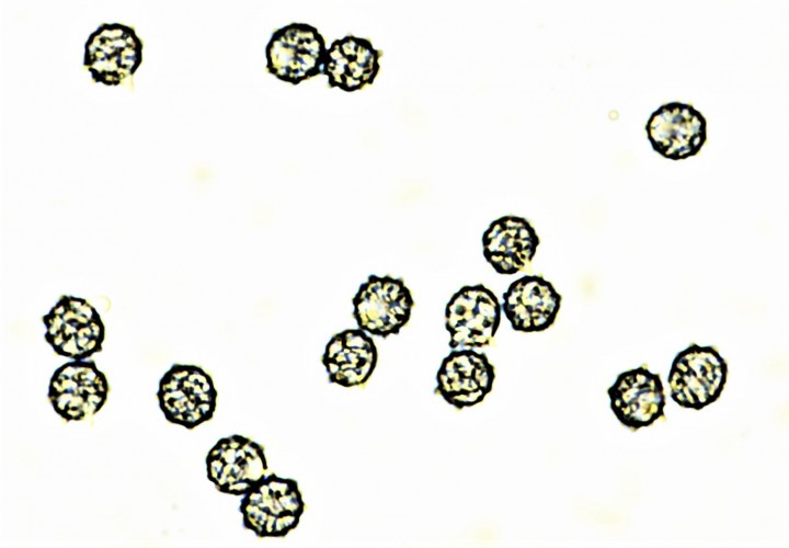 6,4-7,4 X 6,1--6,7µ.jpg