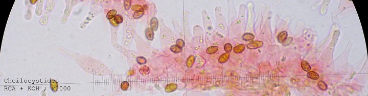 cheilocystides.jpg