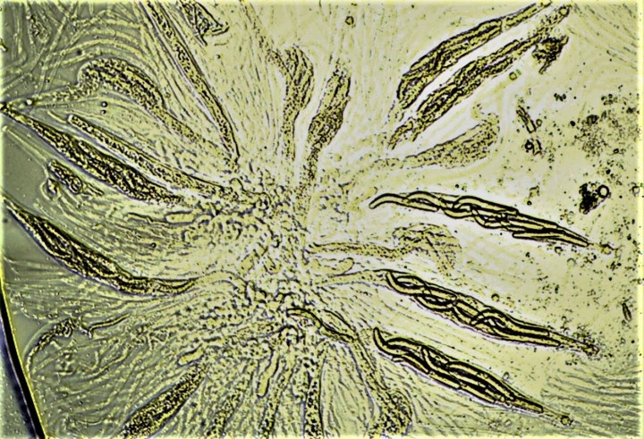 ASQUES ET SPORES