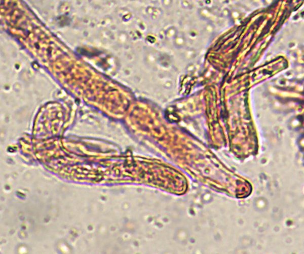 hyphes_x400_02.jpg