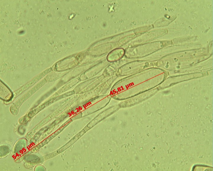 Peziza varia 40 X  paraphyses (JP).jpg
