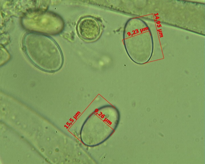 Peziza varia 100 X (JP) (2).jpg