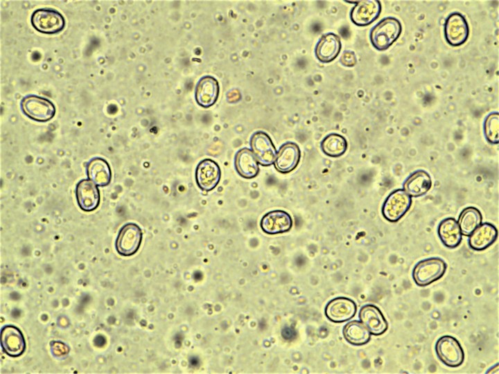 Spores 6,4-7,4 X 4,1-4,7 µ.