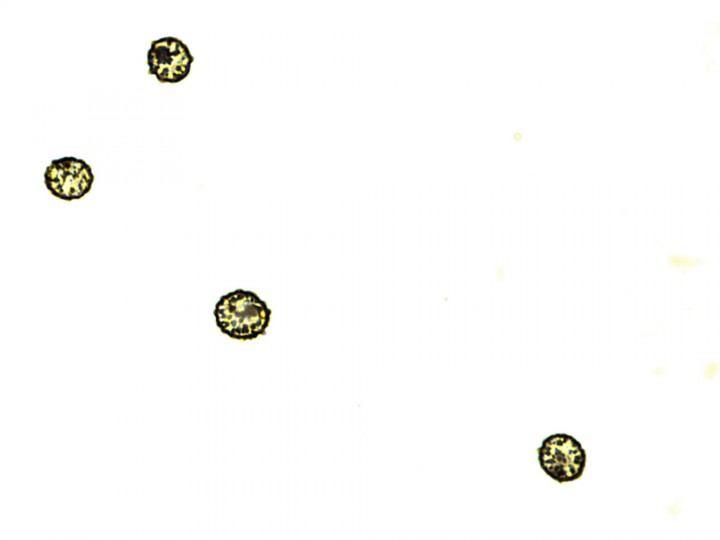 7,2-8,2 X 6,7-7,4 µ.jpg
