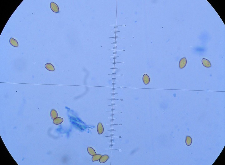 Spores finement verruqueuses avec plage hilaire distincte. (8,2)8,9-10-10,8(11,4) x (5,8)6,1-6,6-8(8,1)