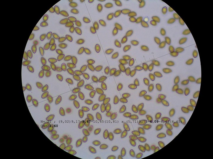 spores mesurées de face