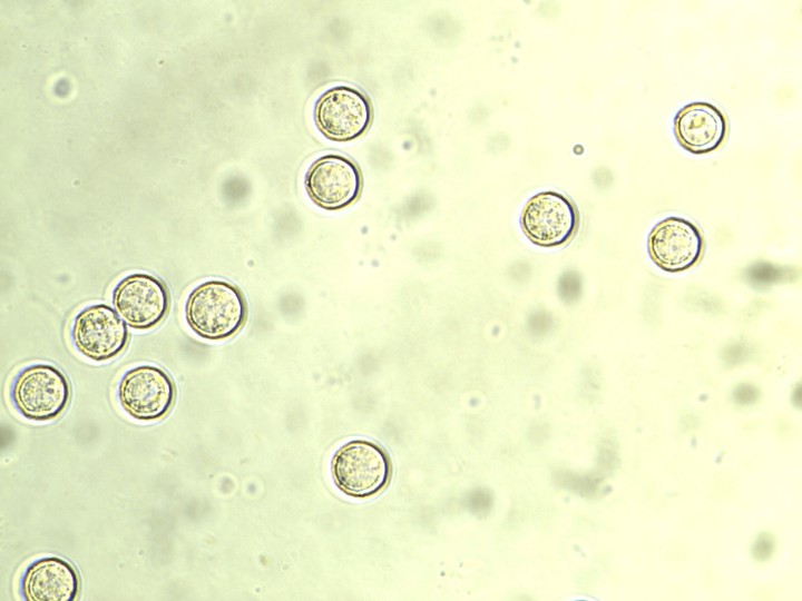 A.DENUDATA Spores 6,8-8µ