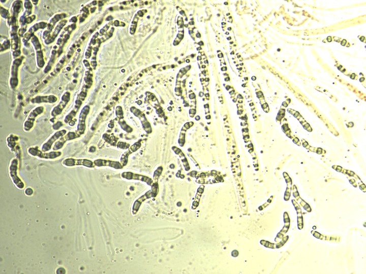 Spores 23-28 X 4-5µ