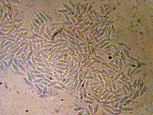 serpula