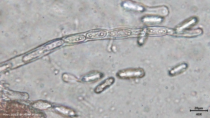 spore-pézize2022-03-05-17-33-21_1400web.jpg