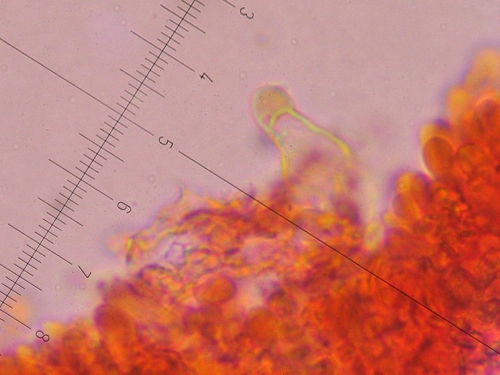 Gloeocystide