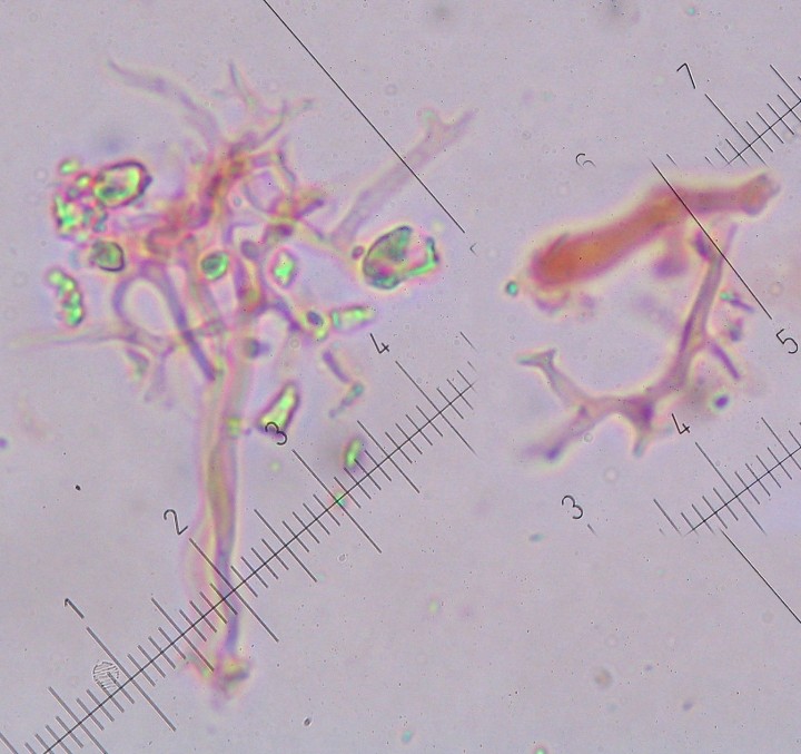 Dendrophyses