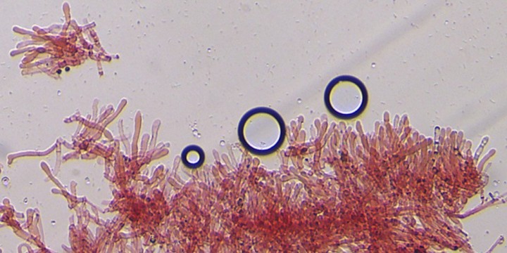 Caulocystides nombreuses uniquement au sommet du pied