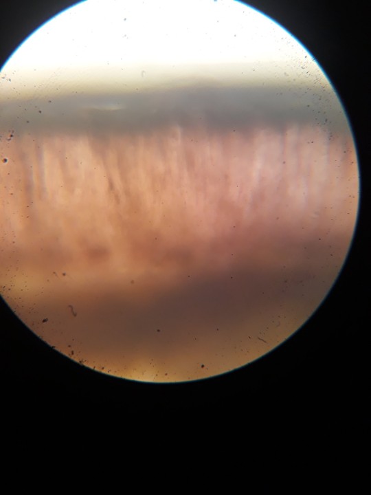 Hyménium