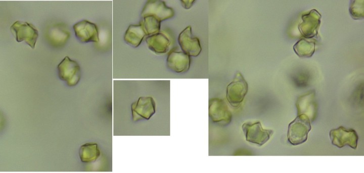 Spores Entolome.jpg