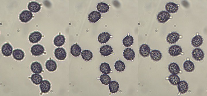 spores_x1000_03.jpg