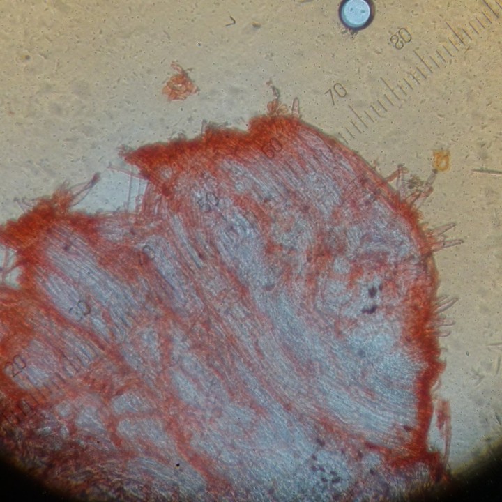 Caulocystides en haut du pied (gradations 3.75 µm)