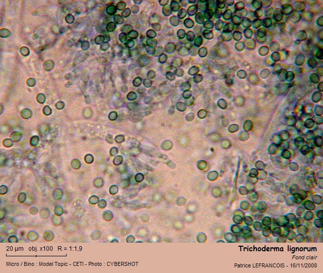 trichoderma_lignorum2.jpg