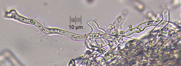 hyphes_x400_03.jpg