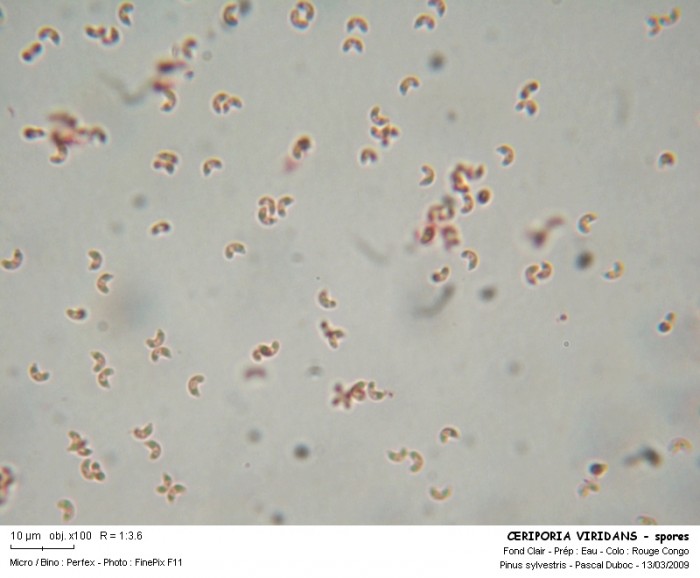 ceriporia_viridans_-_spores.jpg