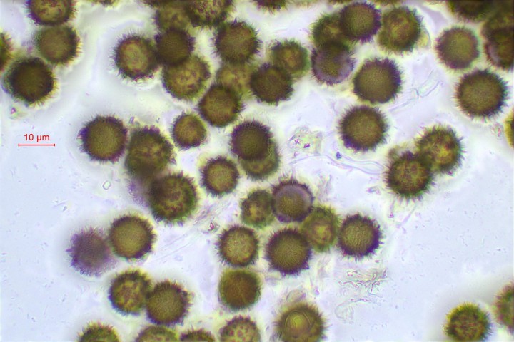spores Scleroderma areolatum.jpg