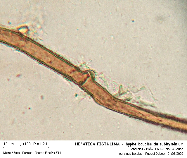 hepatica_fistulina_-_hyphe_bouclee_du_subhymenium.jpg