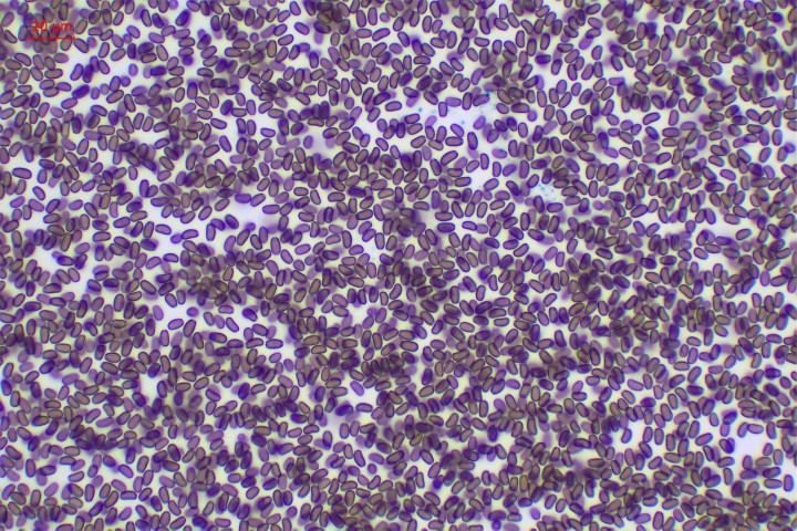 N= 20 ; 7-8  x  3,5-4,5 µ ; Qm= 1,86