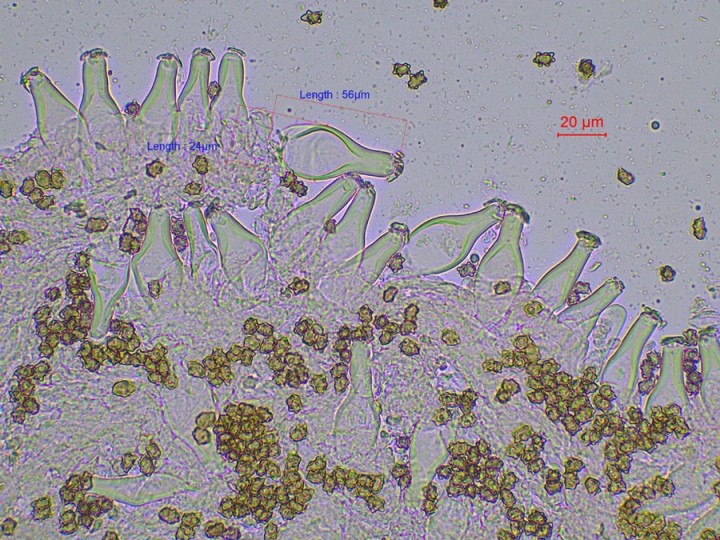 cheilocystides