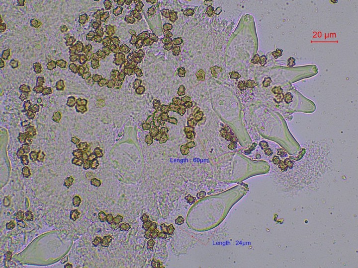 pleurocystides