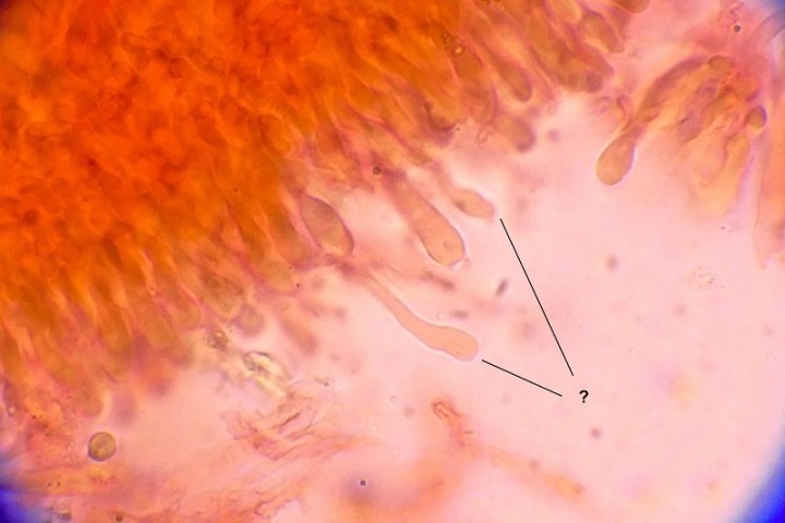cellules filiformes