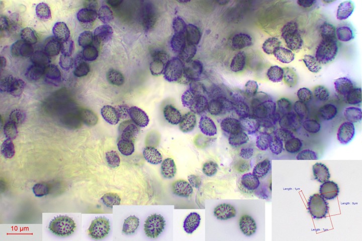spores russula Joel.jpg