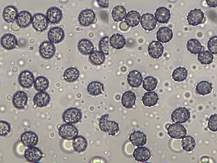 spores_x1000_01.jpg