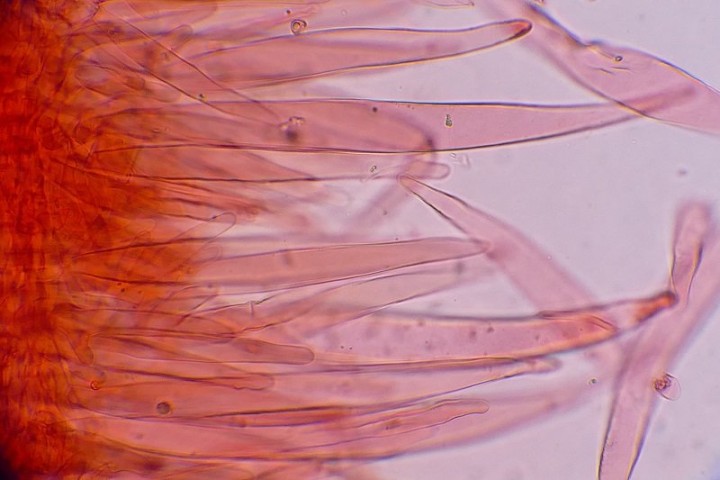 Photo 8 X 1000 Revêtement de la cuticule (cellules trichodermiques)