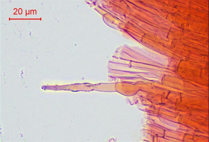 Caulocystide coiffée