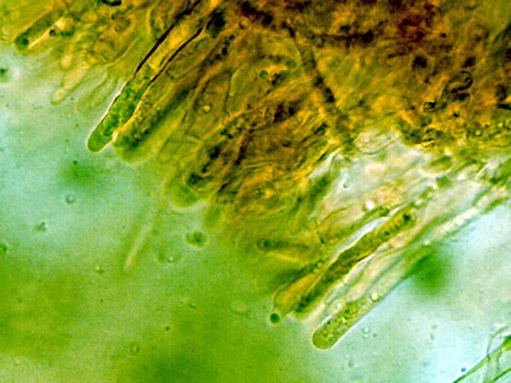 &quot;Gleocystides&quot; de Laxitextum bicolor