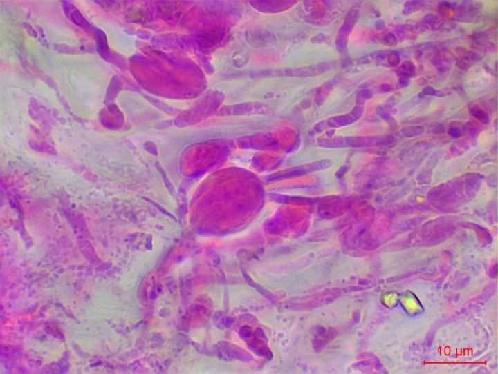 hypobaside2.jpg
