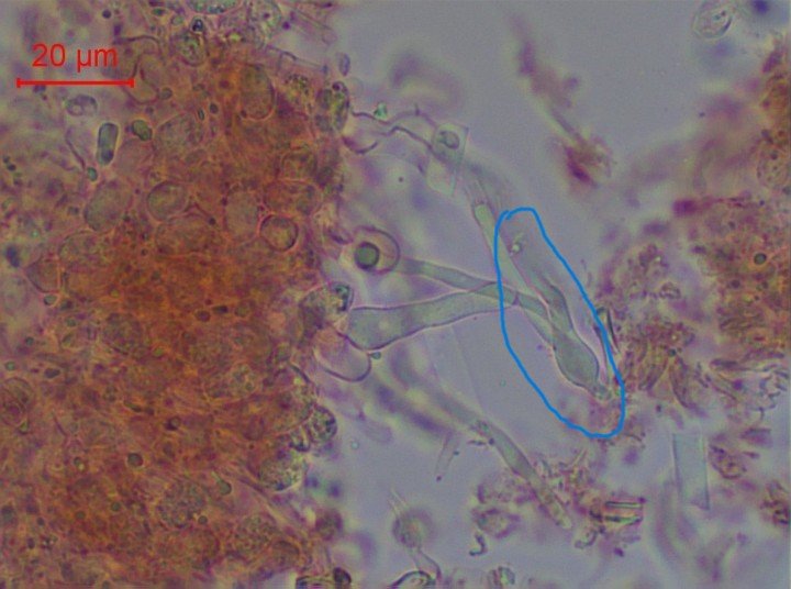 hyménium et spores-001.jpg