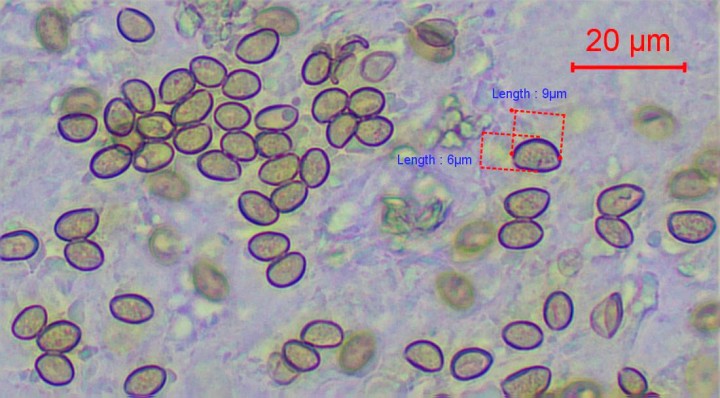 spores dans NH4OH