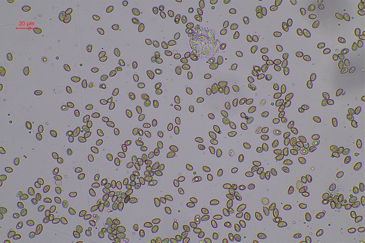 spores dans NH4OH